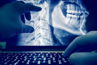 digital x ray in hyderabad