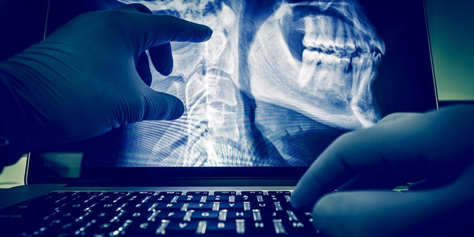 digital x ray in hyderabad