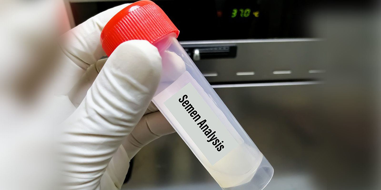 Semen Analysis