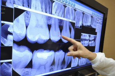 digital x ray in hyderabad