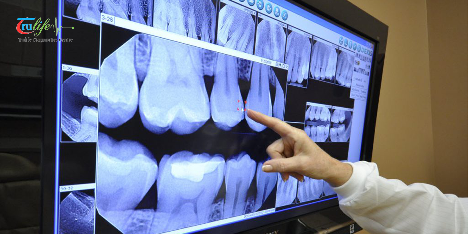 digital x ray in hyderabad