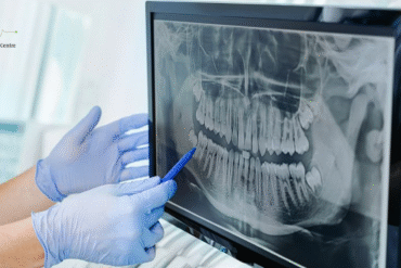 digital x ray in hyderabad