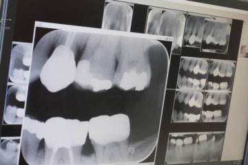 Digital X Ray Narsingi