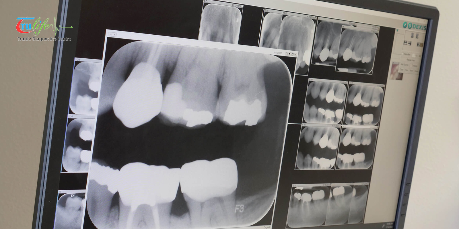 Digital X Ray Narsingi