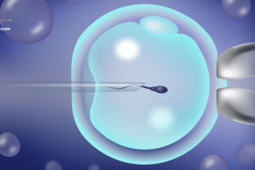 Semen Analysis in Narsingi