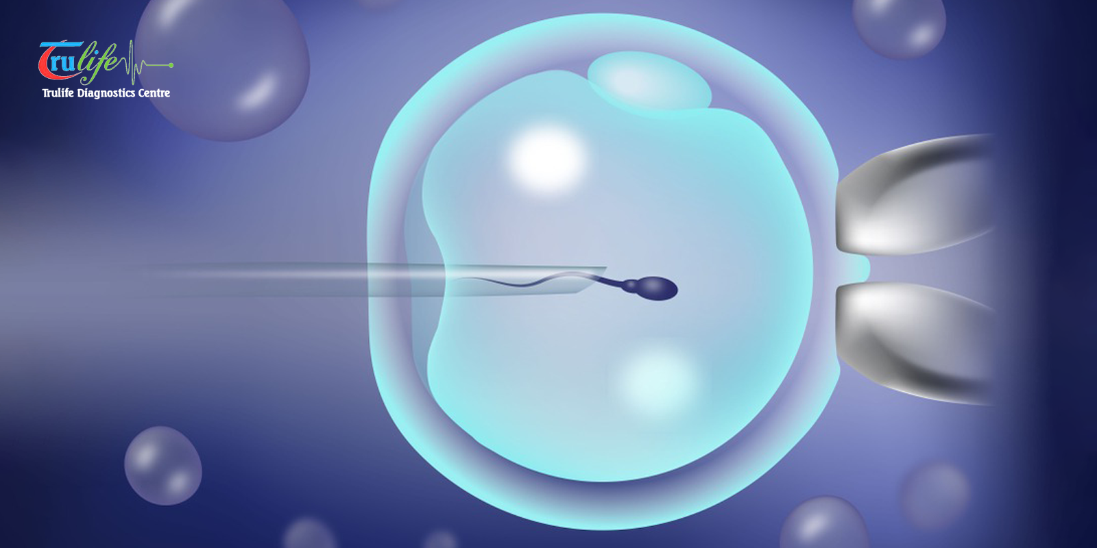 Semen Analysis in Narsingi