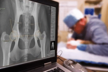 Digital X Ray in Narsingi