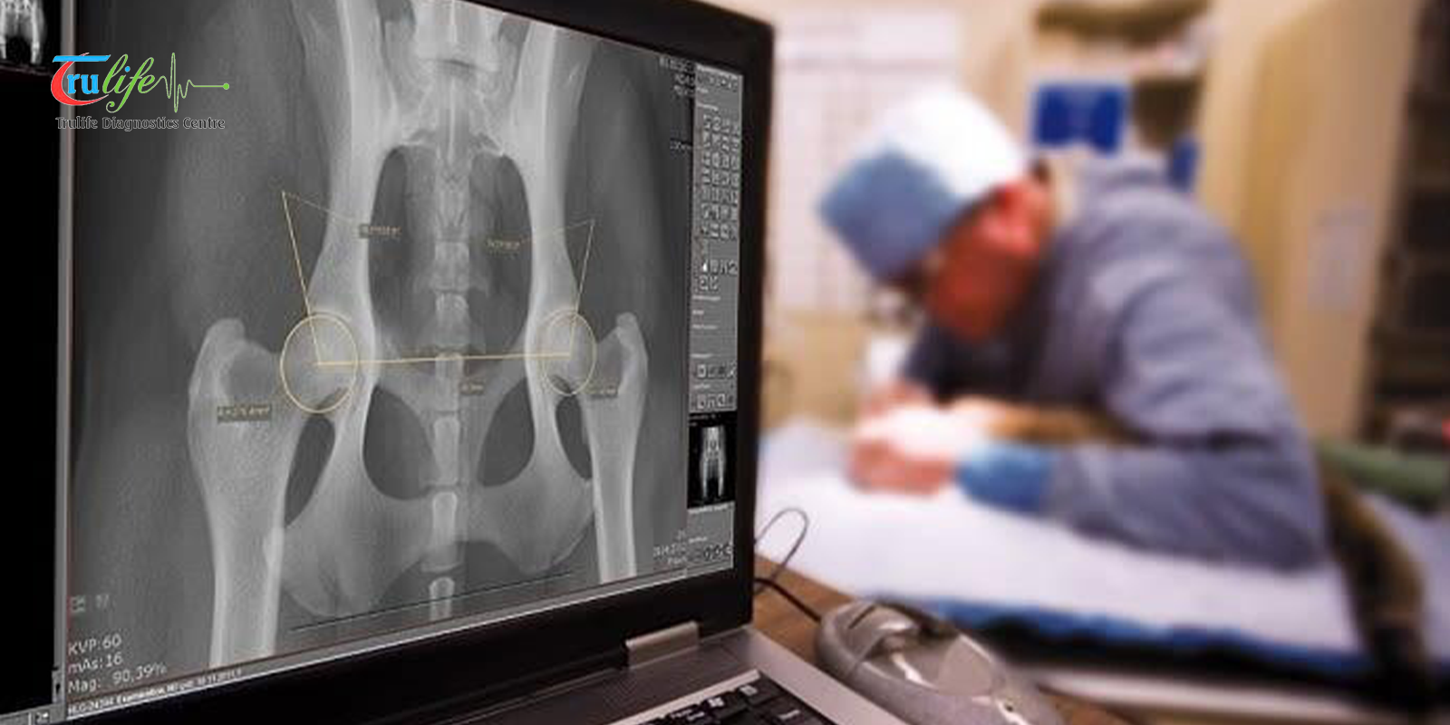 Digital X Ray in Narsingi