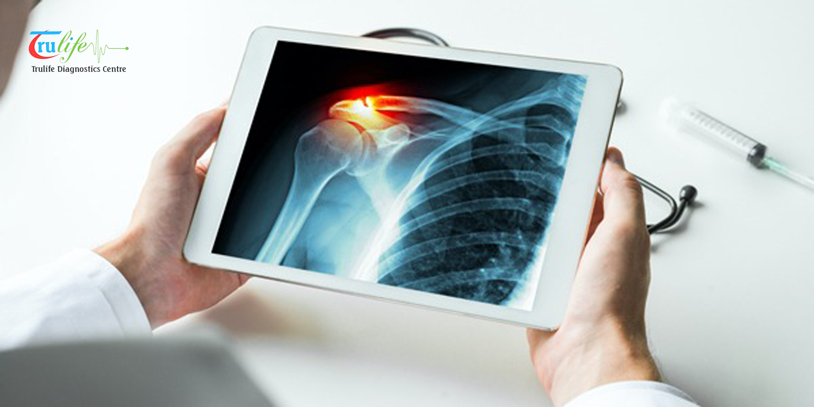 Digital X-Ray in Hyderabad