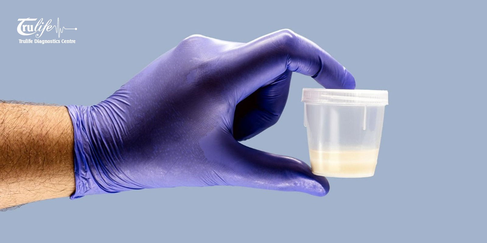 Semen Analysis in Hyderabad