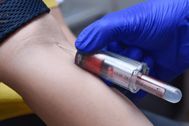 Home Blood Test in Narsingi