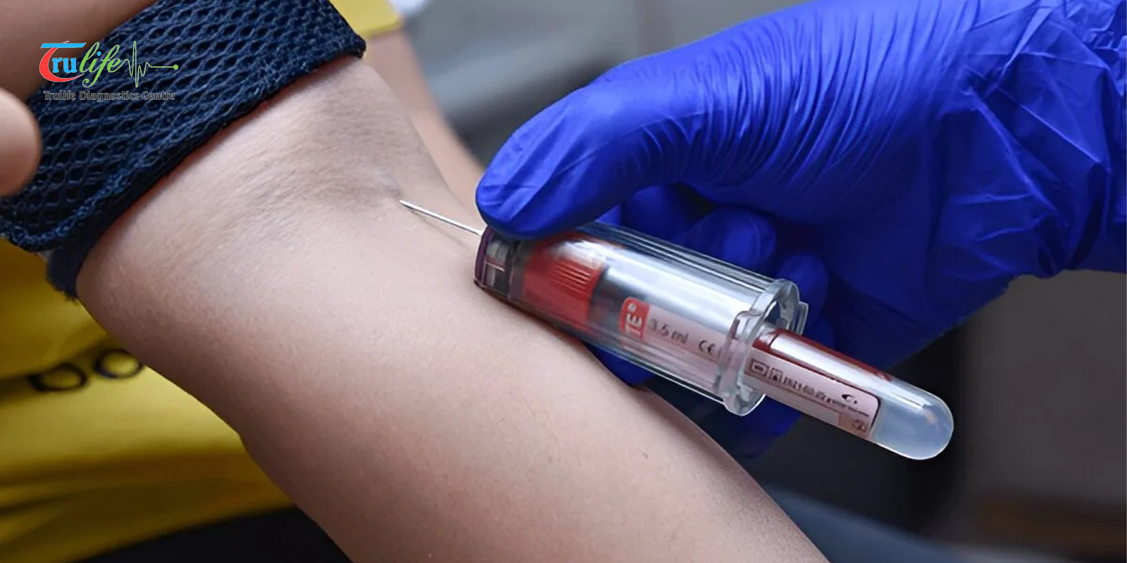 Home Blood Test in Narsingi