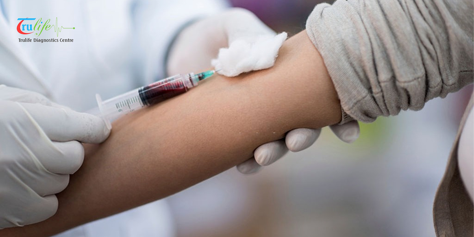 Lab Test in Narsingi