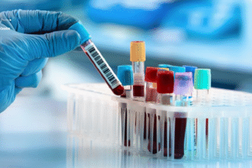 Lab Test in Narsingi