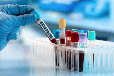 Lab Test in Narsingi