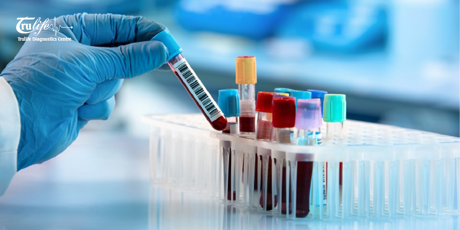 Lab Test in Narsingi