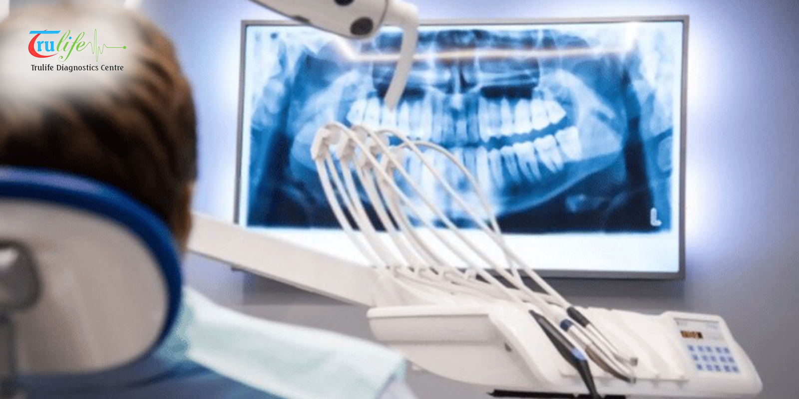 Digital X-Ray in Narsingi