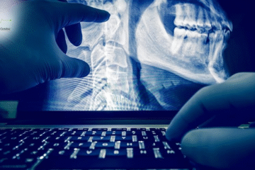 Digital X Ray in Narsingi Hyderabad