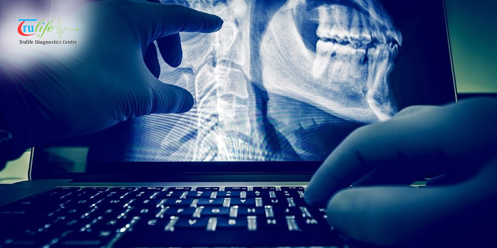 Digital X Ray in Narsingi Hyderabad